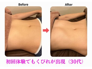 エーシーサロン 六本木店(acsalon)/遺伝子解析なしでもこの変化!