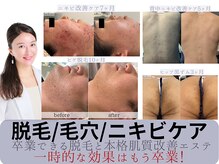 サロン イナンナ(Salon INANNA)