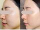 ソルニコン(Solnikon)の写真/毛穴・くすみ・たるみ・肌荒れに悩む大人女性の本格肌質改善ケア