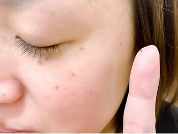 クルル(KROL)/ついにポロッと取れ出した!