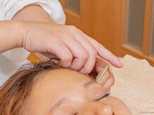 ハリルナ(hari.luna)/美容鍼施術風景