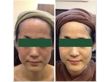 ビーカーブス 三鷹(B.curves)/before・after