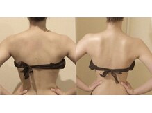 メディカルエステサロン ローズ 鯖江店(ROSE)/ブライダルケアも大人気♪