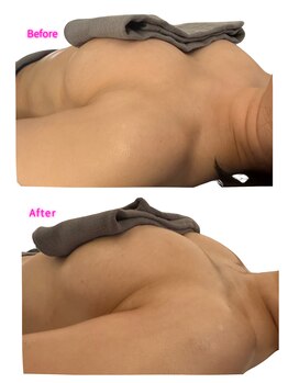 ザ レディービー(The Lady B)/バストケア