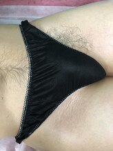 クロレ(Colorer)/ワックス脱毛