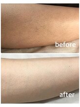 アネモネ(anemone)/ひざ下変身