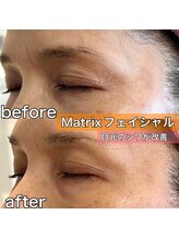 サロンデイジー(Salon Daisy)/Matrix小顔フェイシャル施術一回