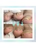 すぐに痛みが和らぐ◎巻き爪補正（指2本以上）＋オイルケア11,000円～