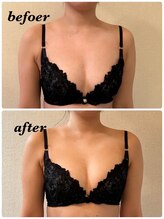 シャルマン(Charmant)/バストのbefore.after