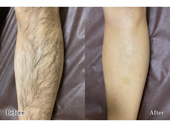 アネル 豊見城(anel)/