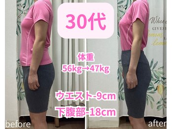 トータルボディーケアステーション 岡山院/30代　耳ツボ　EMS