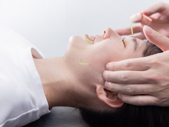 ナチュラルエイジングプラス(naturalaging+)の写真/【美顔鍼×小顔矯正】独自メソッドで、もう疲れてる？なんて言わせない！"切らない"施術で速攻効果実感！