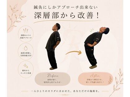 リセット鍼灸院(Risetto鍼灸院)の写真