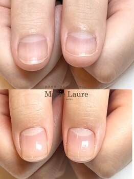 マリーロール 梅田店(Marie Laure)/自爪育成/深爪矯正/ネイルケア