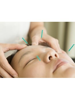 鍼灸施術を受けたい