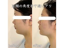 整え屋 レッド(RED)/阿波座/本町/小顔矯正/美容整体
