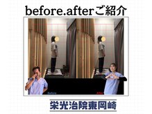 栄光治院 整体院東岡崎/たったの10分の変化！！