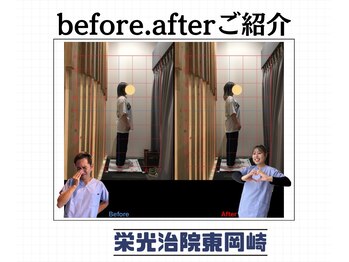 栄光治院 整体院東岡崎/たったの10分の変化！！