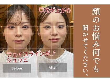 グレース(Grace)の写真