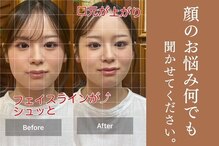 グレース(Grace)