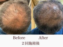 ニイヌマラボ(NIINUMA LABO)の雰囲気（モニター様価格ご用意しております☆）