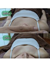 スノードロップ(snowdrop)/1回での変化