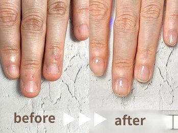 自爪育成で別人の手に♪左手