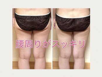 ヨサパーク ひだまり 日立店(YOSAPARK)/見た目から変わります