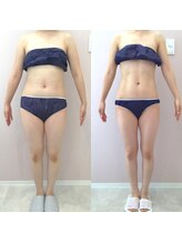 リラパドマ 千葉店(Rela Padma)/激痩せ短期集中ダイエットコース