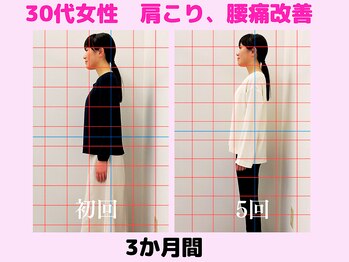 さく整骨院 新松戸店/30代、肩こり、腰痛改善♪