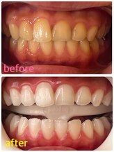 ホワイトニングセンター 浦添市役所前店/那覇市・浦添市・ホワイトニング