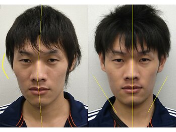 宮崎整体院/【小顔・顔の歪み矯正】