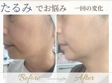 サロン ド コスメ ベル フルール(Salon de Cosme Belle Fleur)の雰囲気（シミケア/くすみ/たるみに徹底アプローチ☆結果重視の本格エステ）