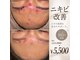 エクラ(eclat)の写真