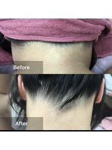 アンド 四條畷店(AND)/魅せるうなじへ