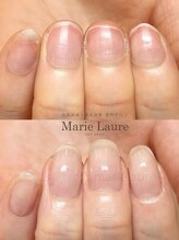 マリーロール 淀屋橋本店(Marie Laure)/自爪育成/深爪矯正/ネイルケア