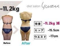 ユズ(yuzu)の雰囲気（【体型崩れに】大人女性に大人気♪骨盤ダイエットはならyuzuへ）