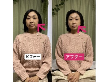 整体院りょう 高槻市/#ほうれい線 #たるみ改善