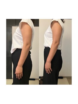 カラダミックス(karadamix)/産後の姿勢変化