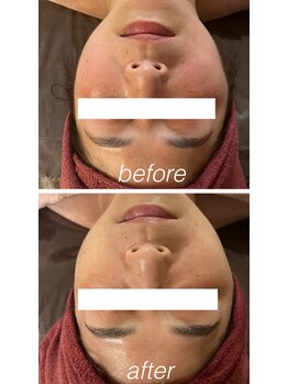 ミルティー(Myrtille)/ララピール