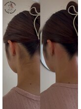 フォーエバービューティフル(Forever Beautiful)/Before & After