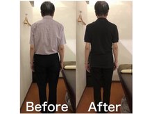 カワル整体 上通り院/綺麗な姿勢なのに腰が痛い人