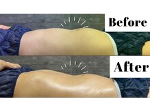 オールハンドでしっかり効果実感◎