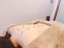 高田馬場はりきゅう院/自律神経の乱れへの鍼灸