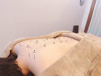 高田馬場はりきゅう院/自律神経の乱れへの鍼灸