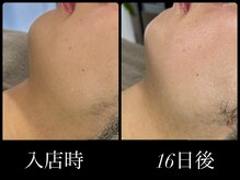 ビーエルティー(blt)/レモンボトル