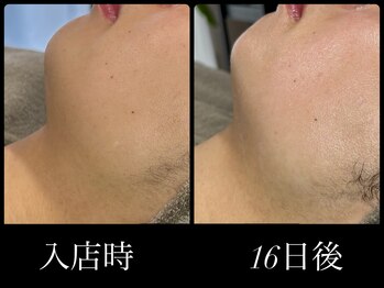 ビーエルティー(blt)/レモンボトル