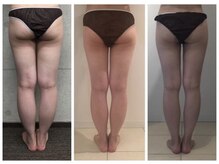 ラメール(la mer)/痩身/エステ/フェイシャル