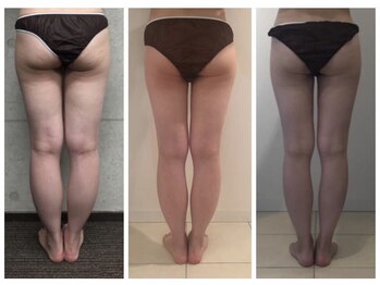 ラメール(la mer)/痩身/エステ/フェイシャル