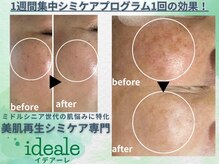 イデアーレ(ideale)